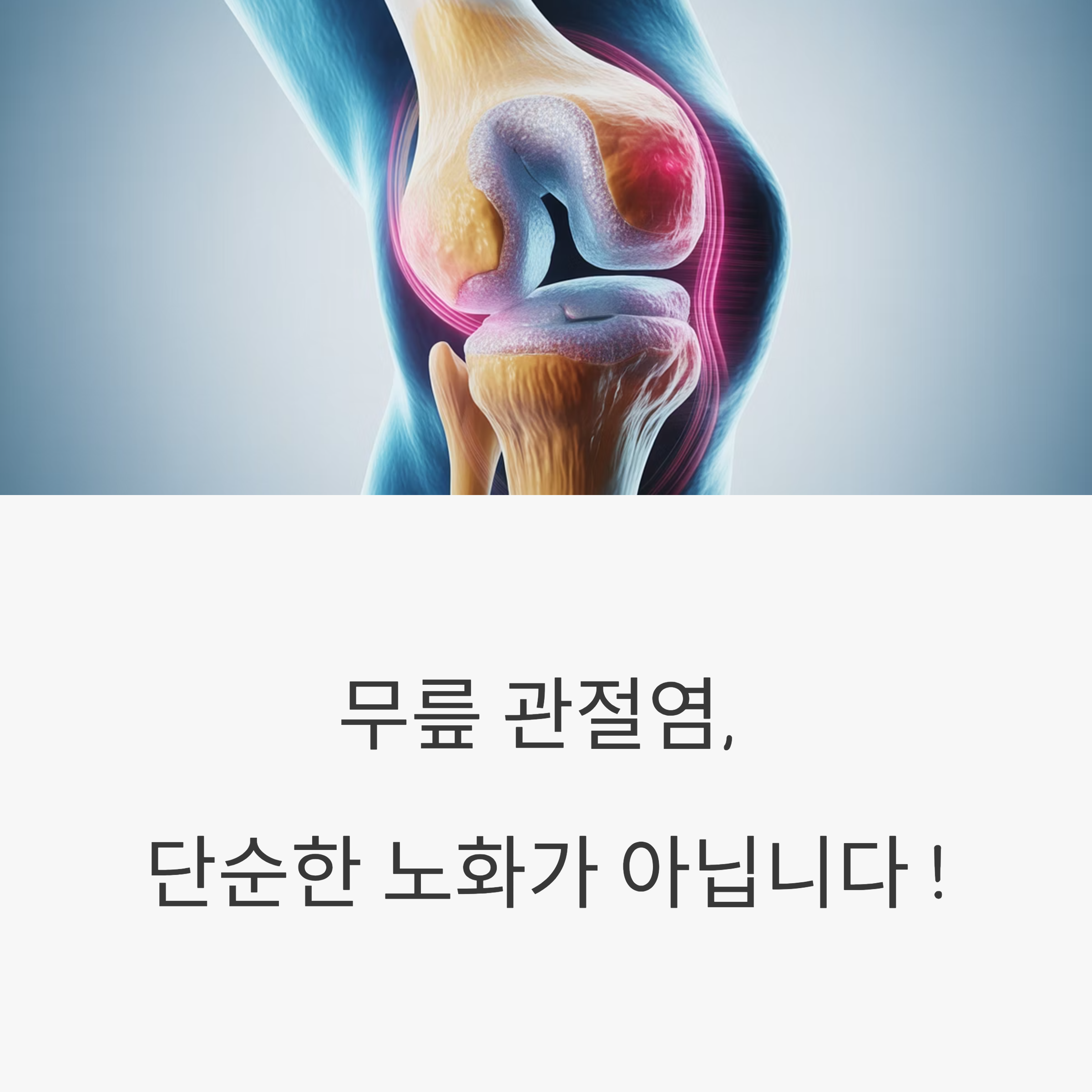 무릎 관절염