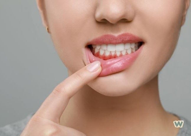 건강한 잇몸 상태 확인 - 잇몸 건강 자가진단 및 셀프 마사지 via Canva