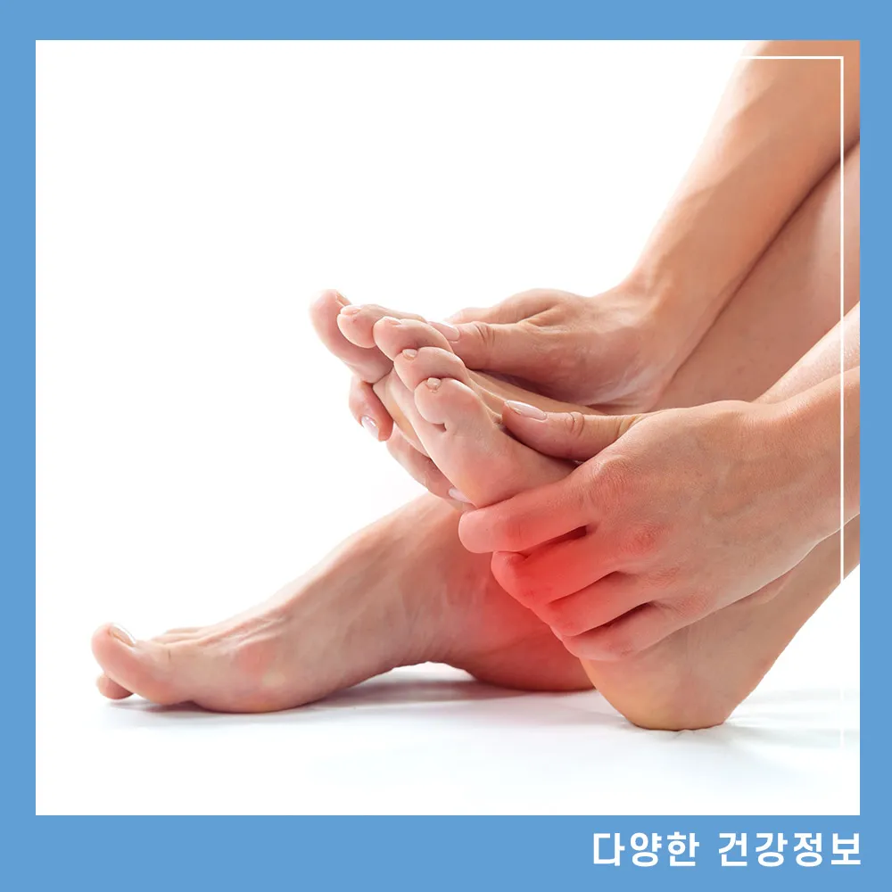 발바닥 가운데 통증 찌릿 원인