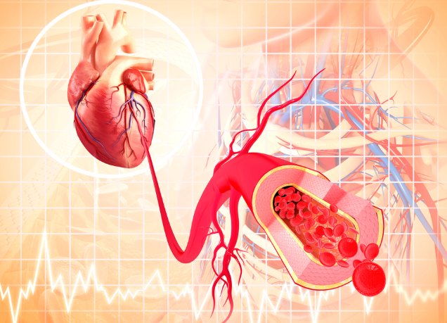 혈관건강 호모시스테인 15분운동 시계운동법 혈관청소 동맥경화예방 고지혈증 혈관나이 저강도운동 건강관리 스트레칭방법