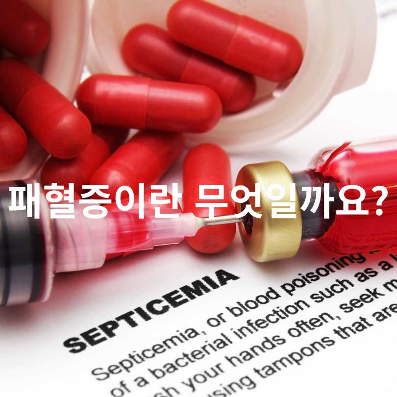 패혈증 예방접종 완벽 가이드