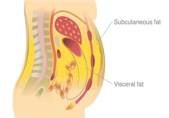 내장지방 레벨 수치
