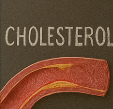 콜레스테롤 정상수치
