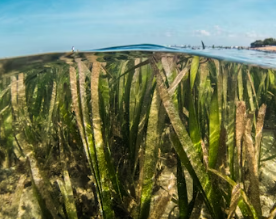 골다공증에 좋은 음식 영양제 식단