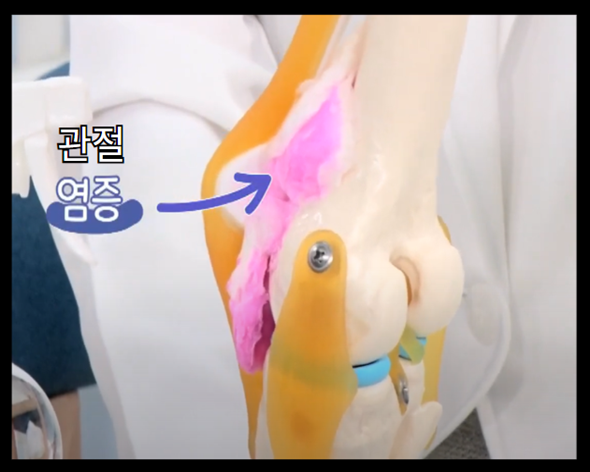 천심련 추출물 파렉틴 - 관절 염증 완화