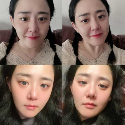 문근영