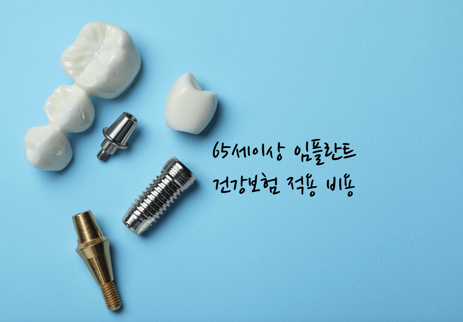 65세이상 임플란트