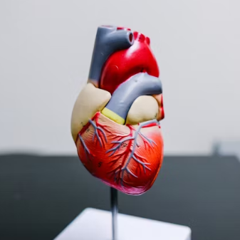 심근경색 진단방법 치료 방법 합병증