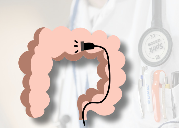 대장내시경-받는-그림