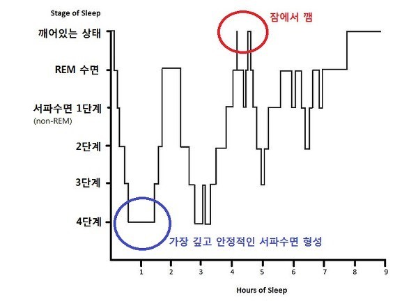 4단계의 수면의 모습