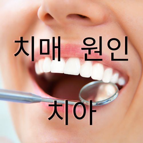 치매원인 치아건강