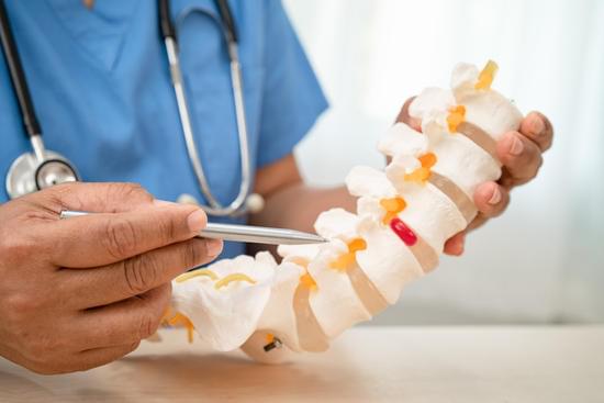 퇴행성 디스크 질환(Degenerative Disc Disease, DDD): 원인, 증상, 치료 및 예방