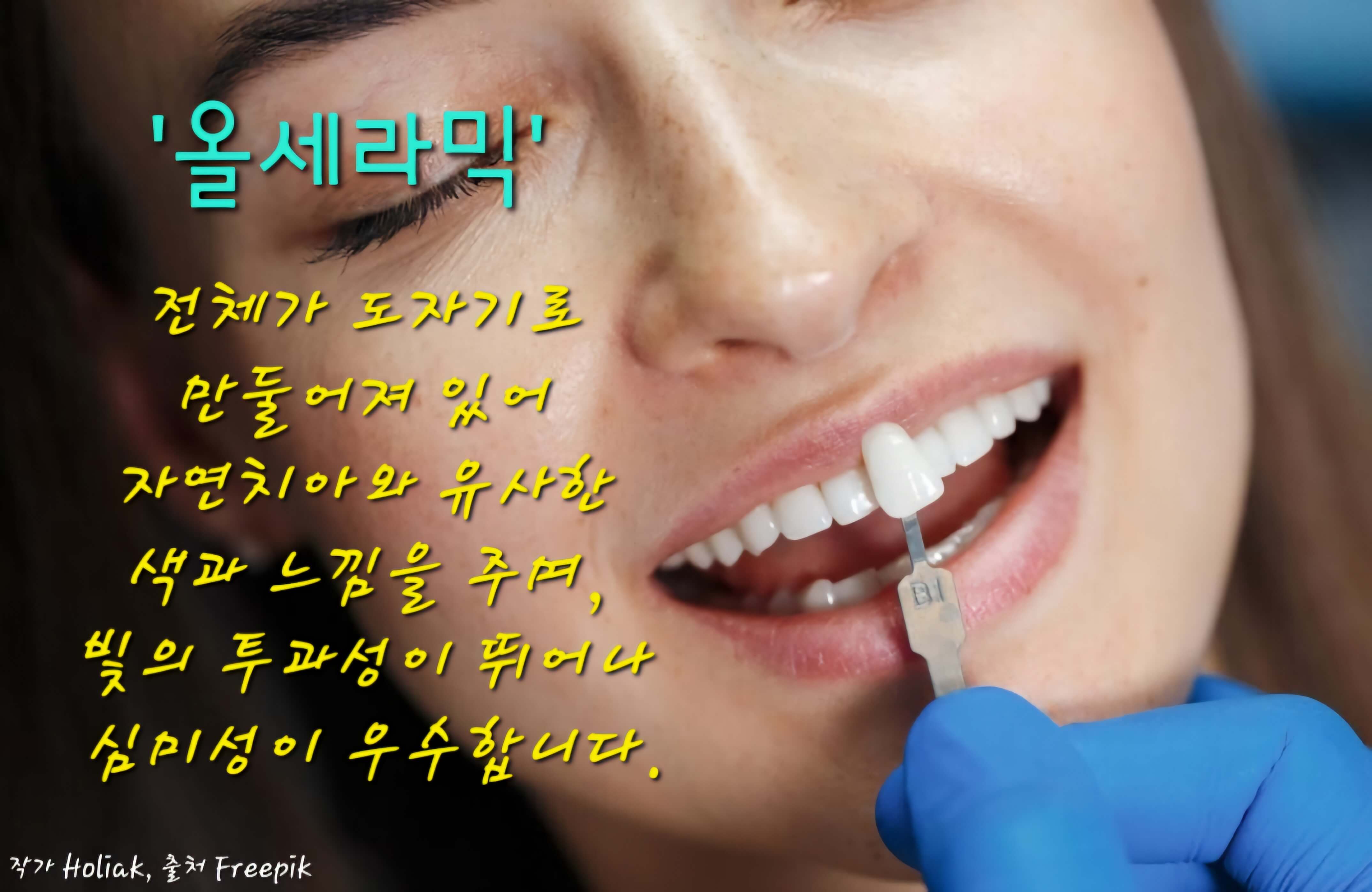 올세라믹 보철 쉐이드 보는 사진