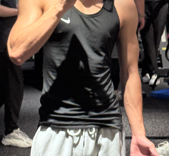 발기 시 귀두 통증, 닥터로반 연고로 발라서 관리했습니다