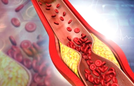 폴리코사놀 대표적 효능 혈관건강 증진4