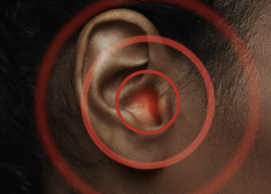 이명 치료방법 증상 원인 좋은 음식 등 총정리(2024 최신)