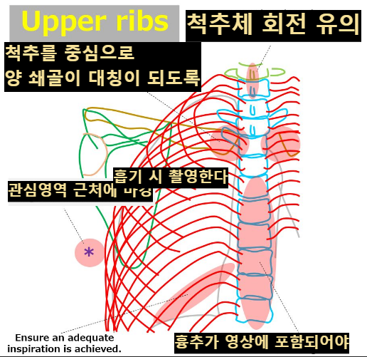 윗늑골 유의사항