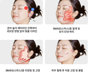 남자리프팅