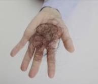 탈모-예방-방법