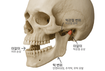 잠잘때 이빨 가는 이유
