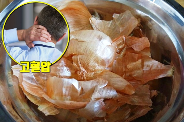 양파 껍질 효능, 고혈압 당뇨 항암, 암이 최고 싫어하는 채소 부위, 건강, 팁줌 매일꿀정보