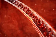 콜레스테롤 개선후