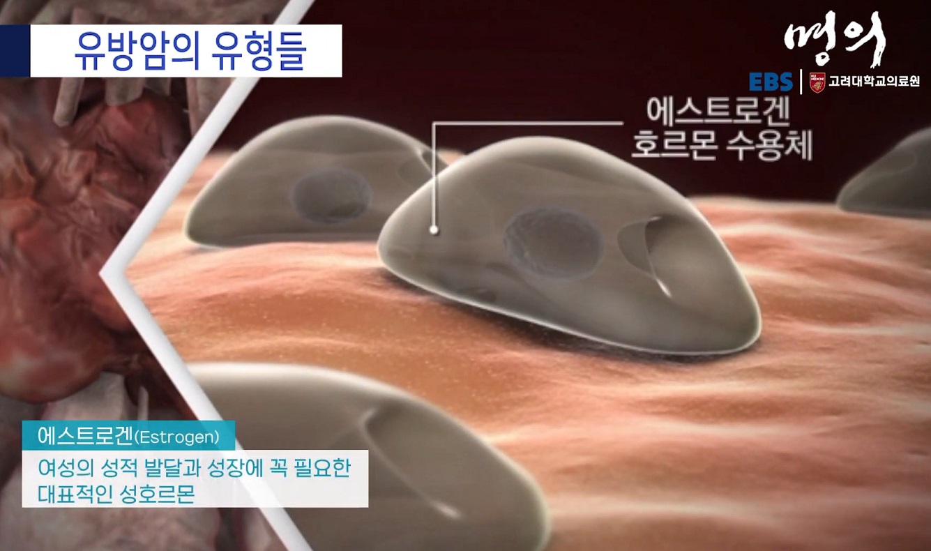 유방내분비외과-우상욱-교수