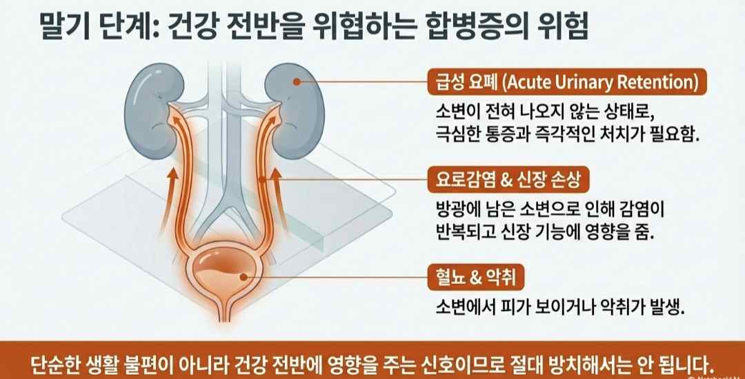 전립선비대증증상-사진3