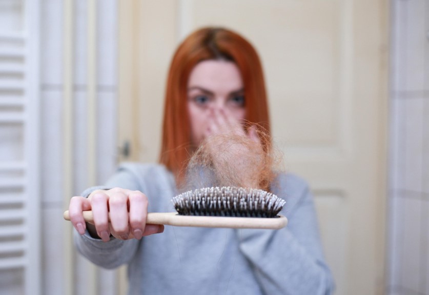 탈모 관련 사진