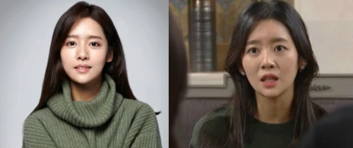 차주영-성형전