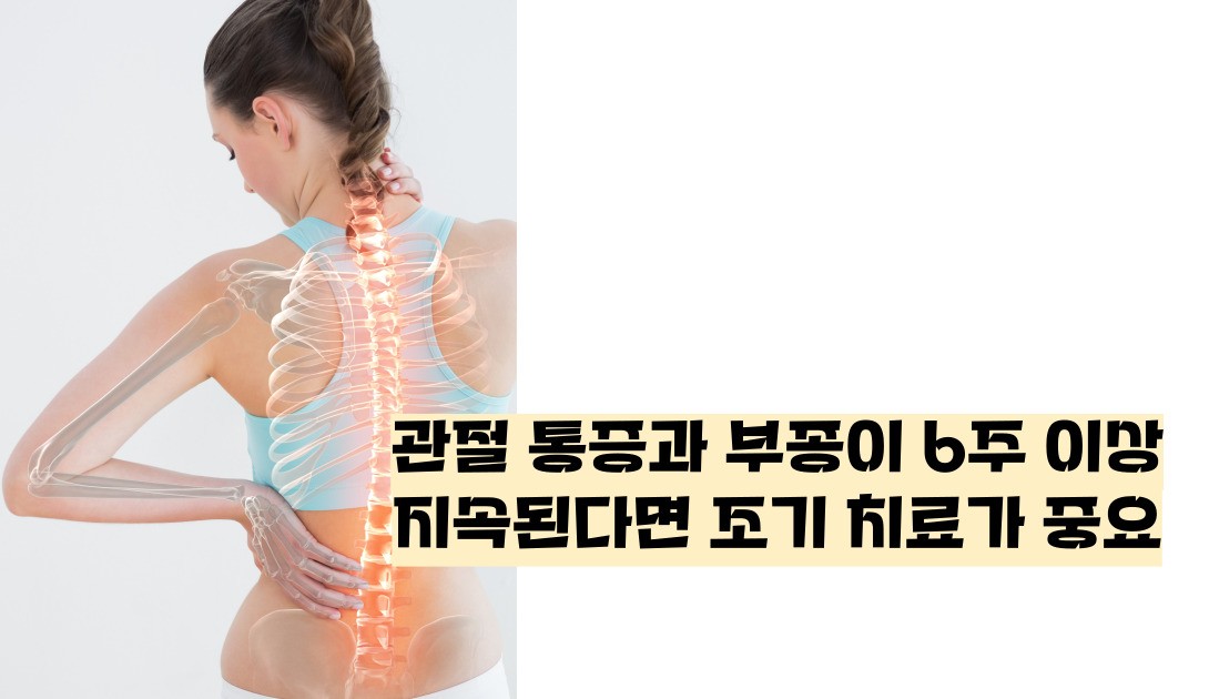 류마티스 관절염 초기증상