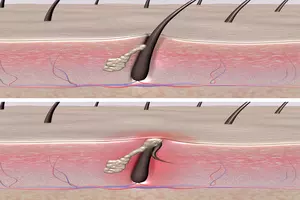 머리숱-많아지는법
