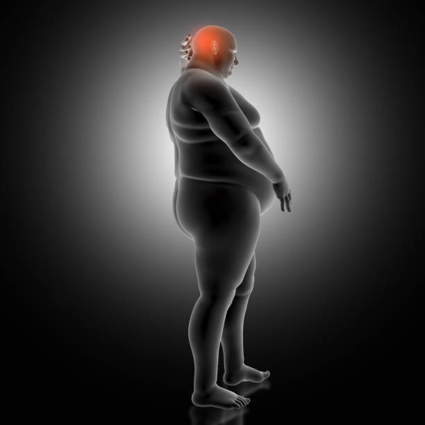 비만 과체중 뇌 BMI 노화 가속 늦추는 법 속도 다이어트 체중 관리