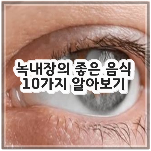 녹내장의 좋은 음식 10가지 알아보기