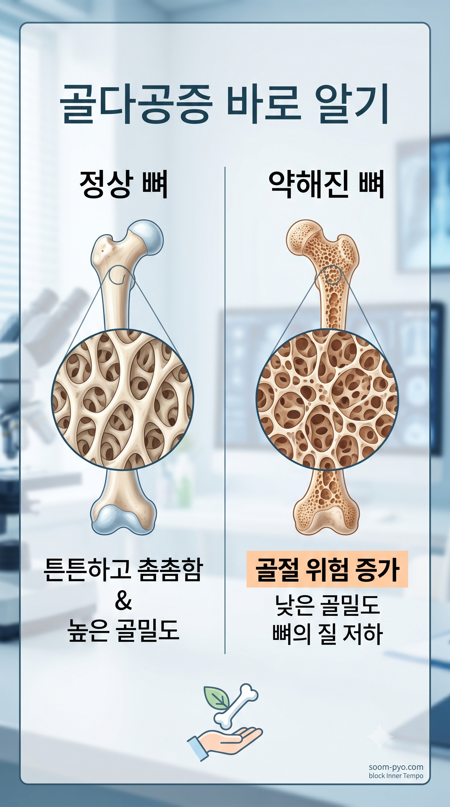 정상 뼈와 골다공증 뼈 비교
