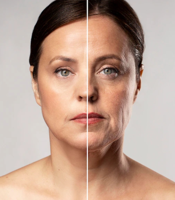 주름이 생기기 전후의 얼굴 비교