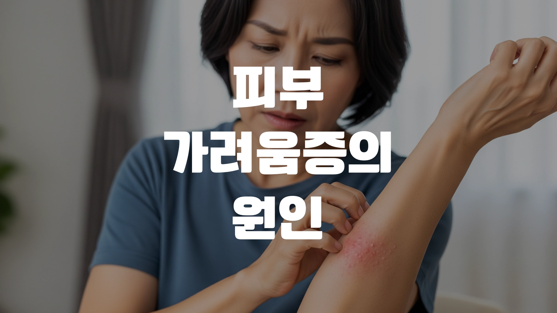 피부가려움증의 원인 증상 총정리! 포스팅 섬네일