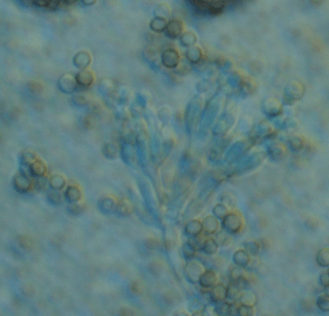 항생제 생산 진균의 이해와 Penicillium 속 진균의 분류 차이