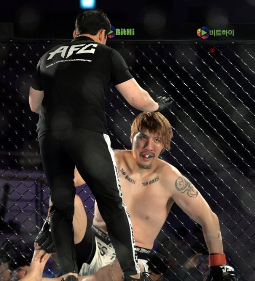 최홍만 뇌종양 수술