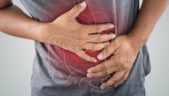 크론병 자가진단