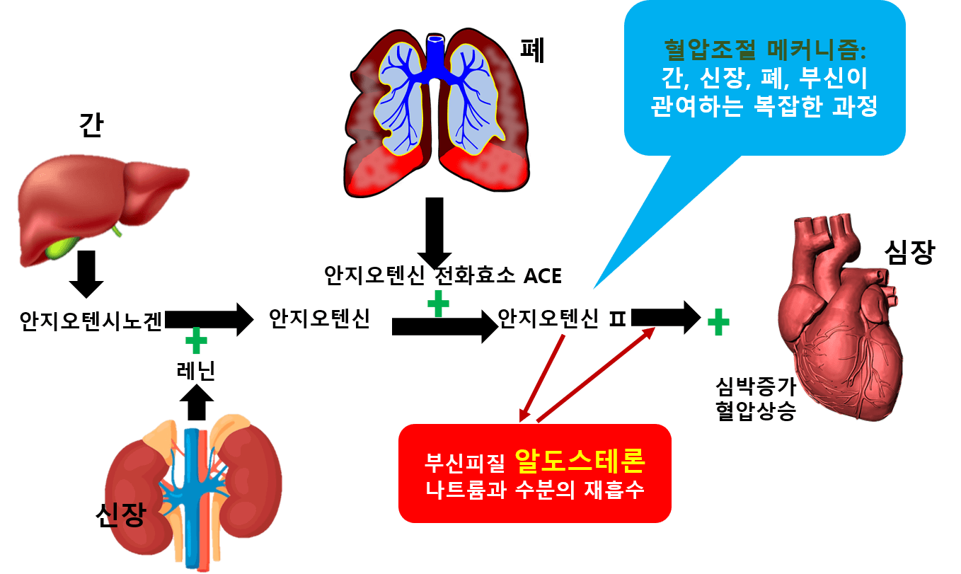 고혈압