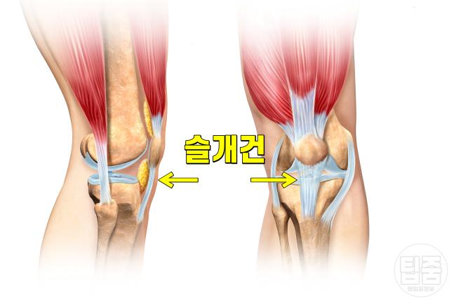 무릎 뒤 통증 원인 건염