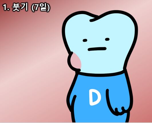 드라이 소켓, 사랑니 발치후 붓기 등 사랑니 발치 후 이상증상 완벽정리