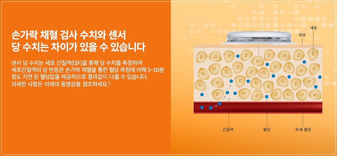 연속 혈당측정기 가격