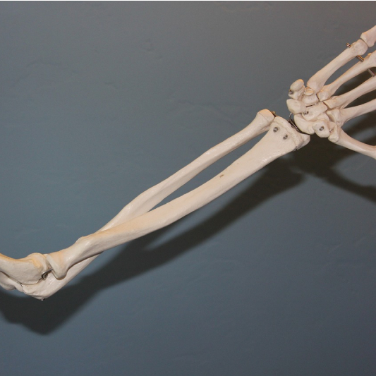 관절염의 이해 : 원인, 증상 및 관리