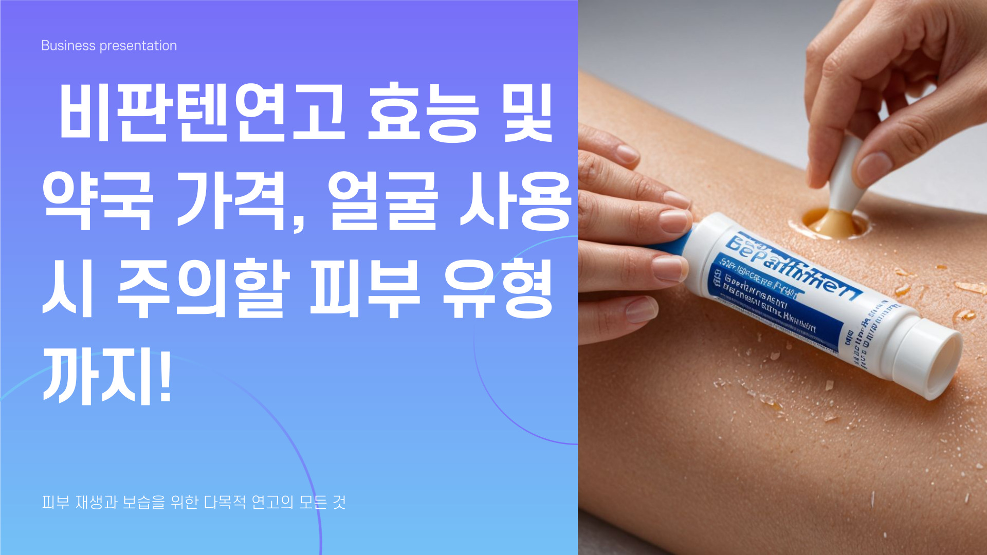 비판텐연고