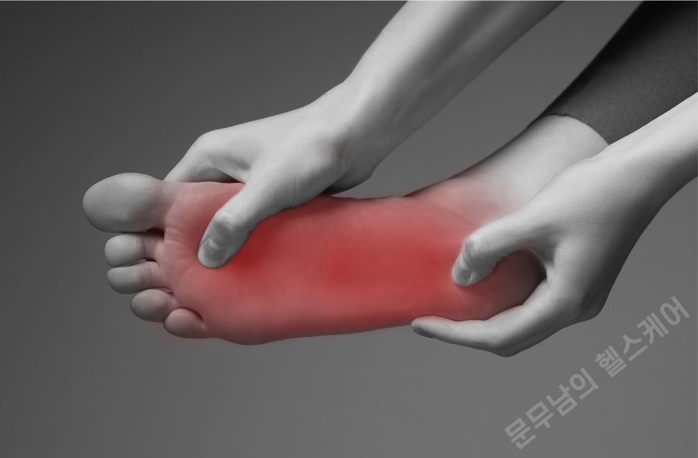 족저근막염 스트레칭 방법