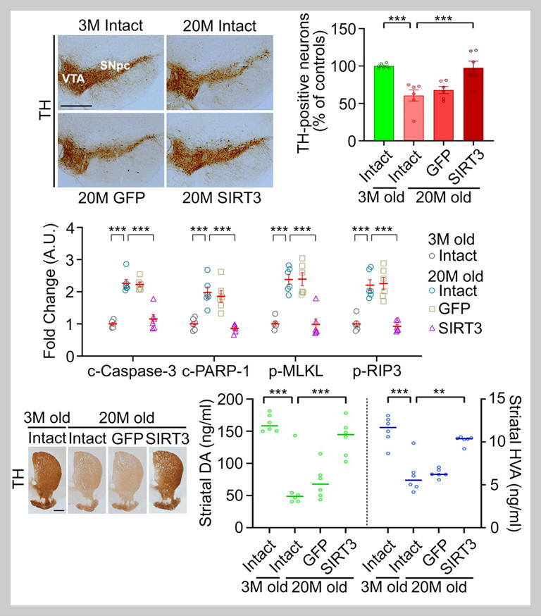 노화 근력 저하, 도파민 신경계 원인