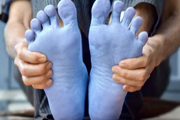 차가운 발 사진