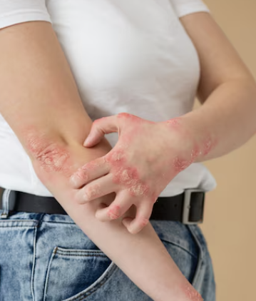 발이 붓는 이유 27